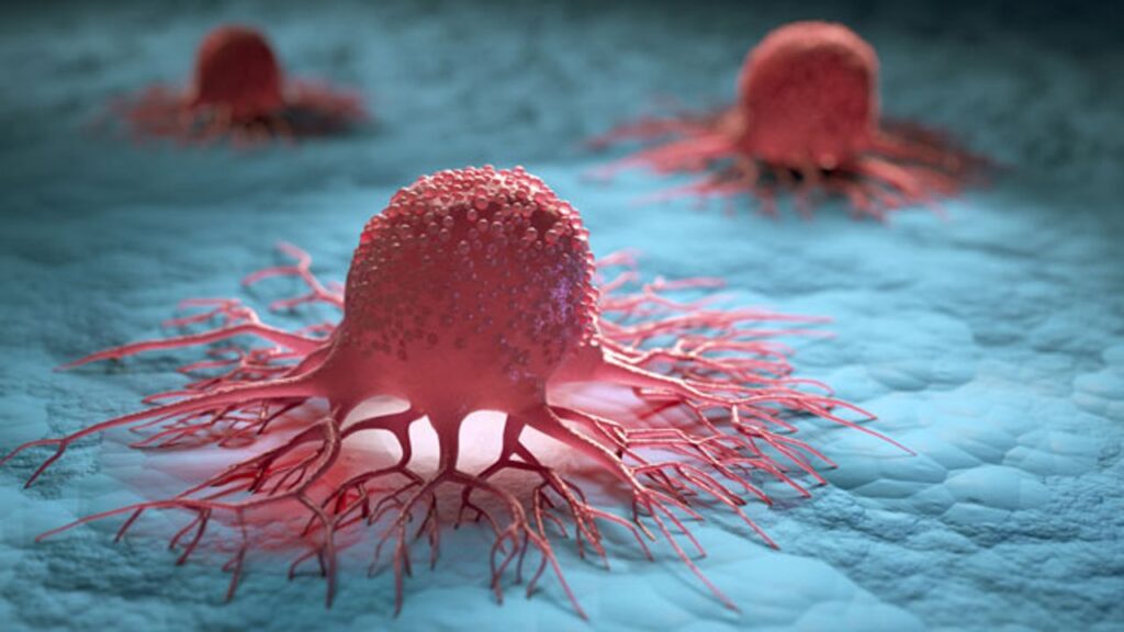 Cancer treatment